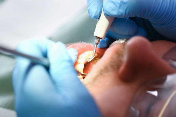 Best Dentist for Severe Toothache  in Welby, CO